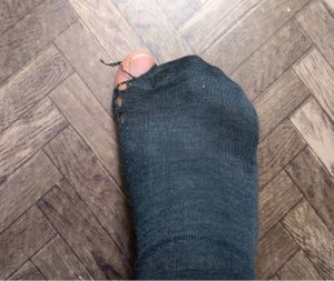 using torn socks